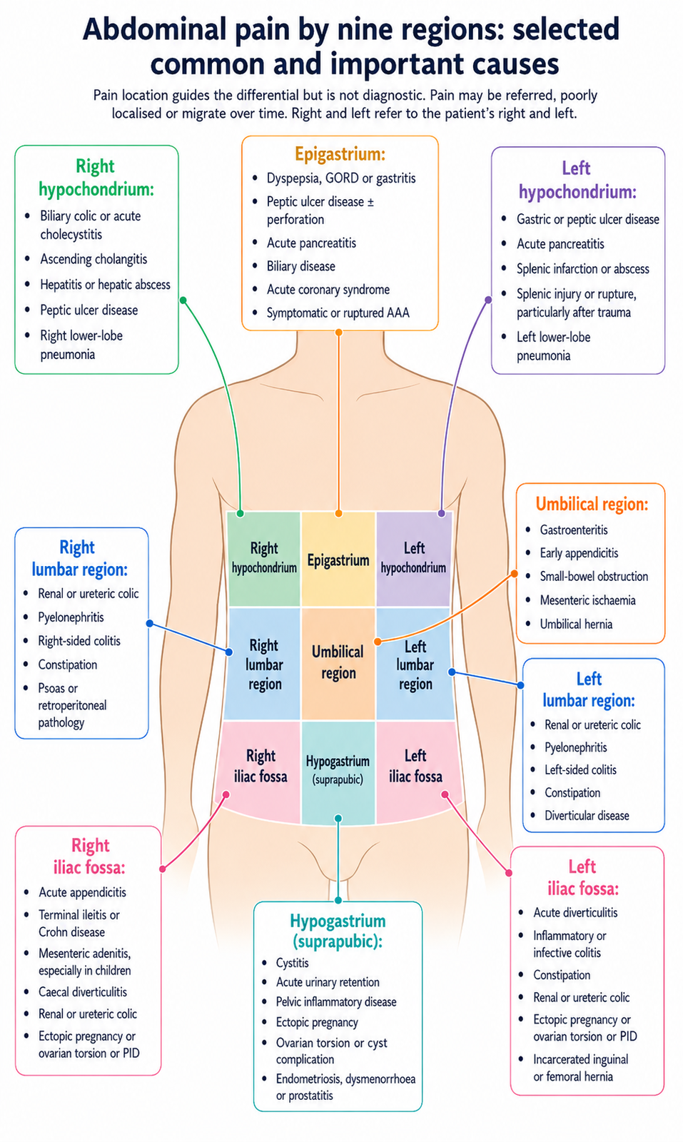 Nine-region map of the abdomen with common and important causes of pain in each region. Location guides the differential but is not diagnostic because pain may be referred or migrate.