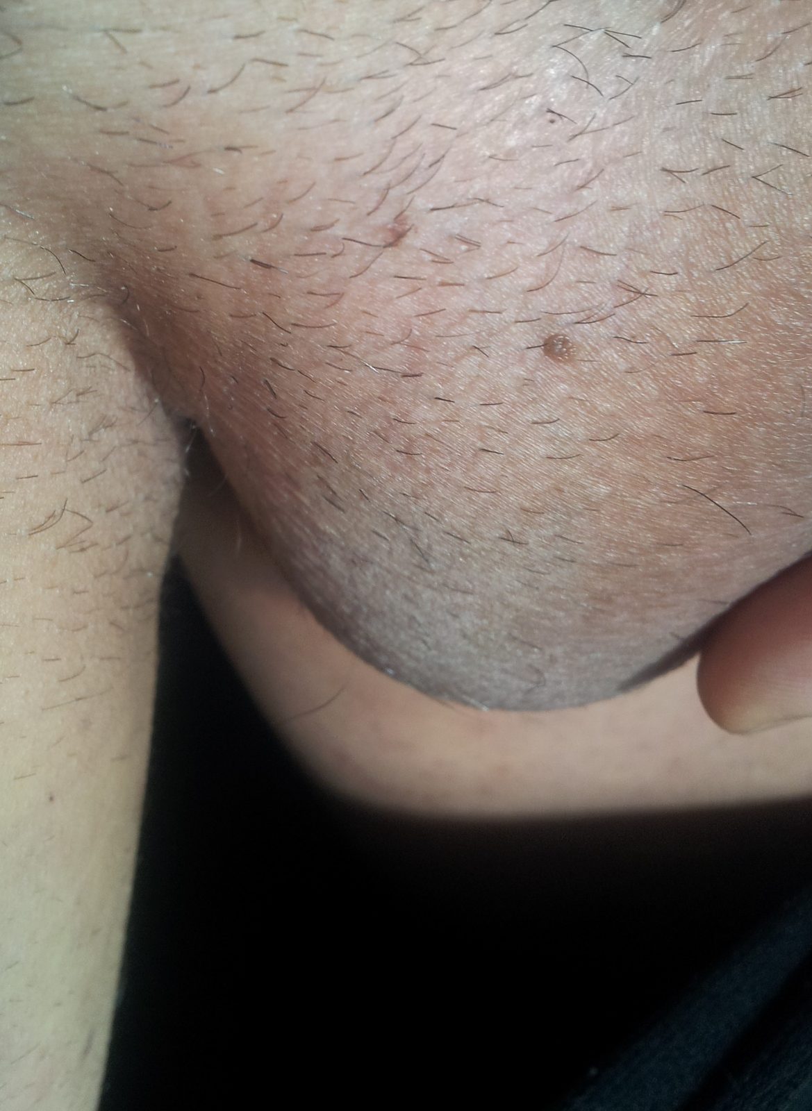 Sensitive clinical image, hidden