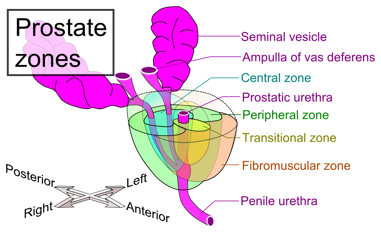 Diagram of the prostate showing the transitional zone around the urethra, where benign hyperplasia develops, and the peripheral zone where most prostate cancers arise.