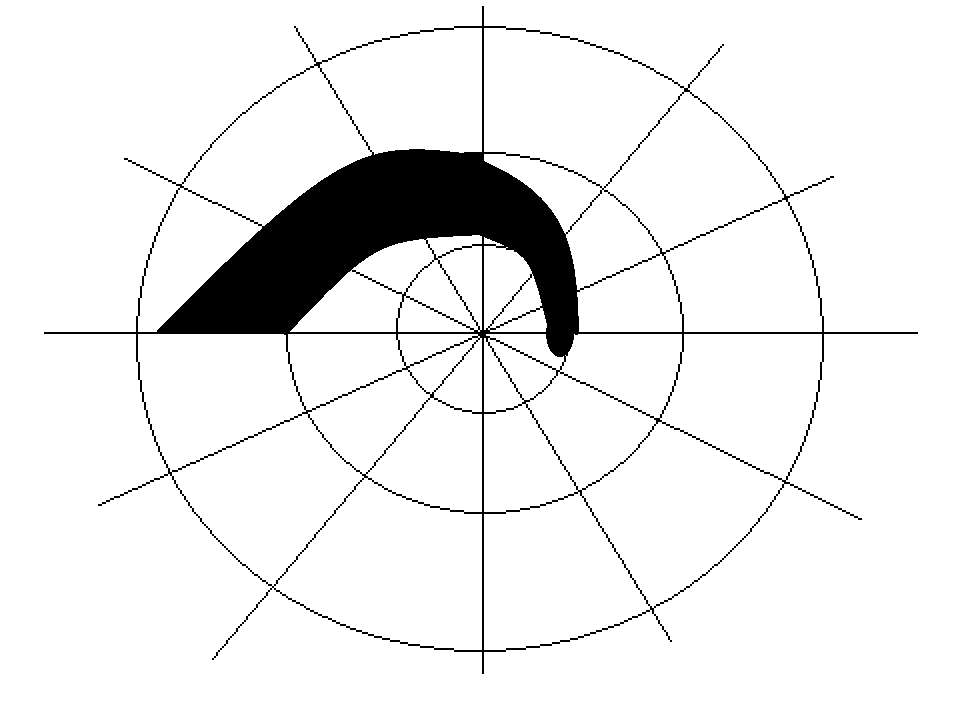 Visual-field record showing a superior arcuate scotoma, a characteristic glaucomatous field defect. Include a reminder that progression is assessed using consistent perimetry over time.