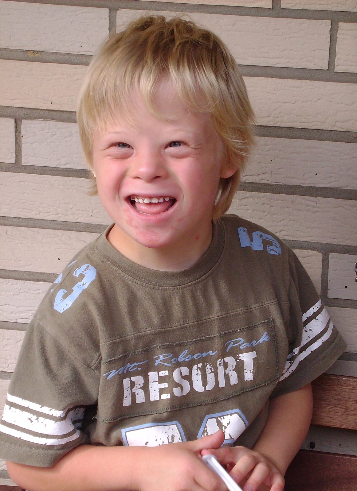 A respectful labelled illustration of common facial and hand features associated with Down syndrome, making clear that not every person has every feature and that features do not determine ability.