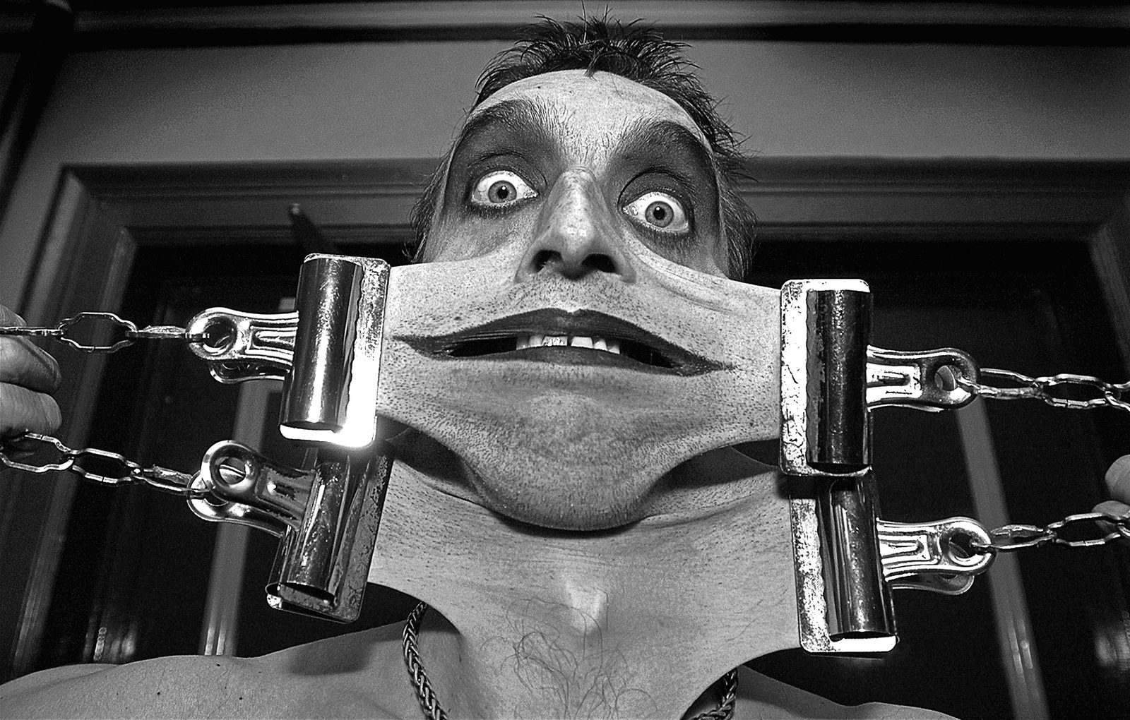 A clinical demonstration of marked facial skin hyperextensibility in Ehlers-Danlos syndrome; the image is for recognising a possible skin feature and is not diagnostic of a subtype.