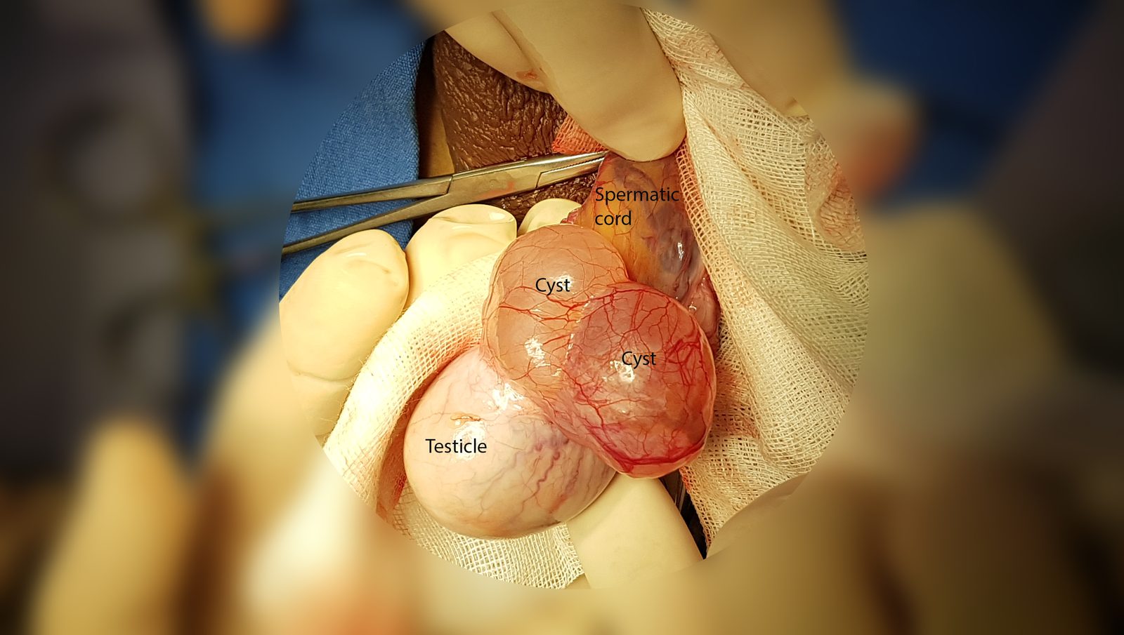 Sensitive clinical image, hidden