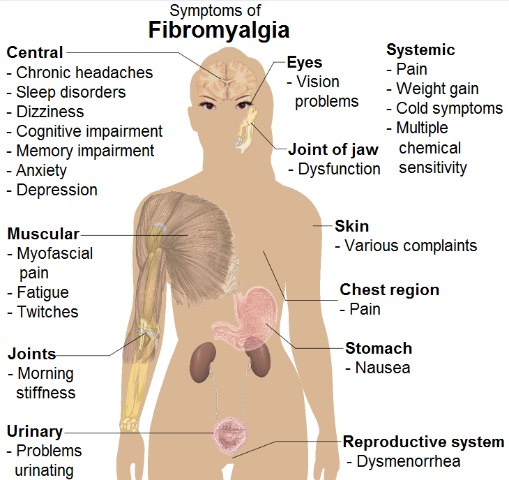 A patient-centred diagram linking widespread pain, fatigue, unrefreshing sleep, cognitive difficulty, mood, function and flare planning to exercise, psychological therapy, symptom review and shared decision-making. Include a warning to reassess post-exertional malaise or objective inflammatory signs.