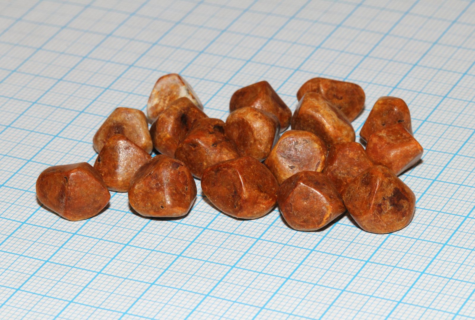 Multiple faceted gallstones removed at cholecystectomy.