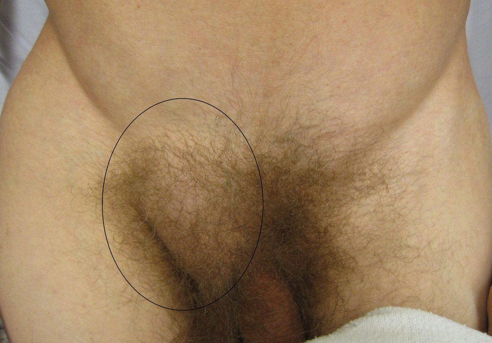 Sensitive clinical image, hidden