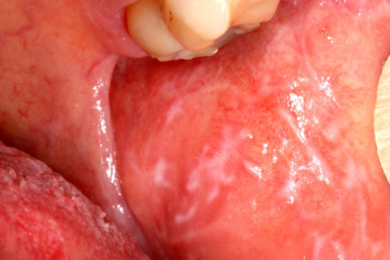 Sensitive clinical image, hidden