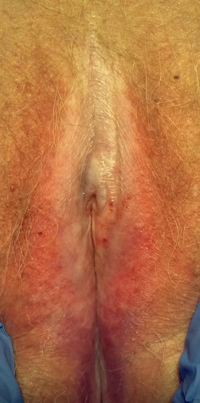 Sensitive clinical image, hidden