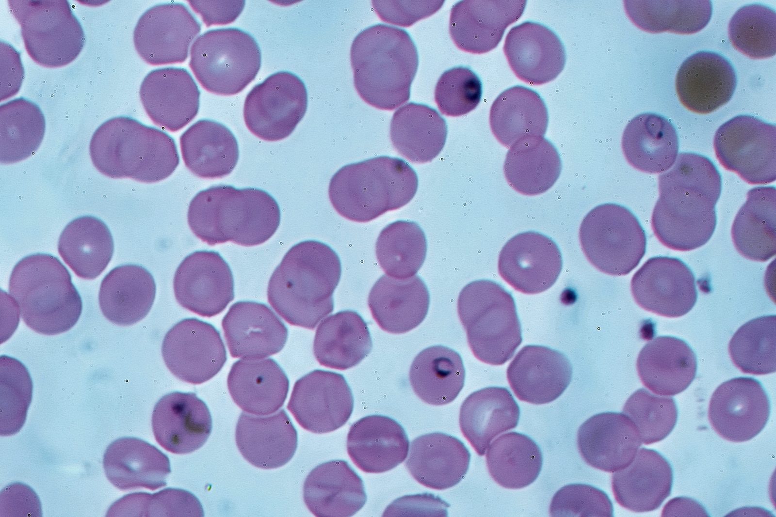 Microscopy image showing Plasmodium parasites within red blood cells on a thin film.