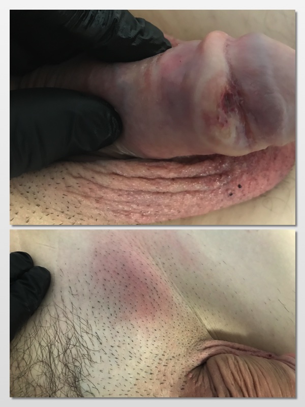 Sensitive clinical image, hidden