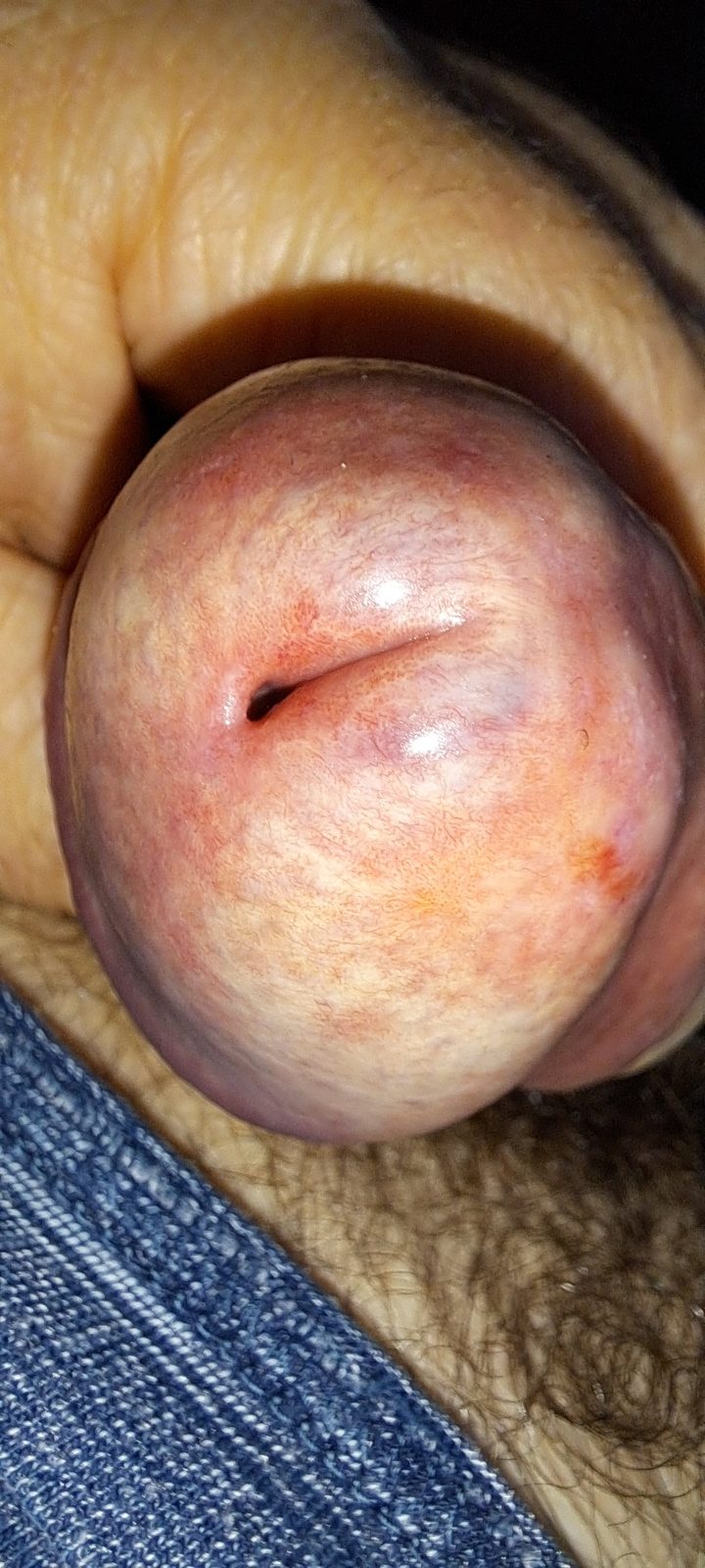 Sensitive clinical image, hidden