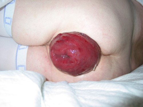 Sensitive clinical image, hidden