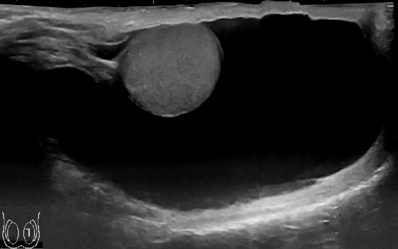 Sensitive clinical image, hidden