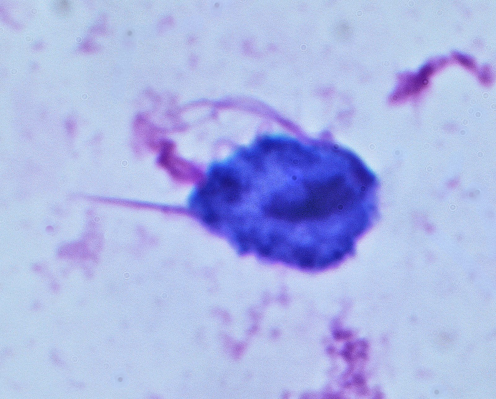 A May-Grünwald–Giemsa-stained micrograph of Trichomonas vaginalis showing its pear-shaped body and flagellar structures.