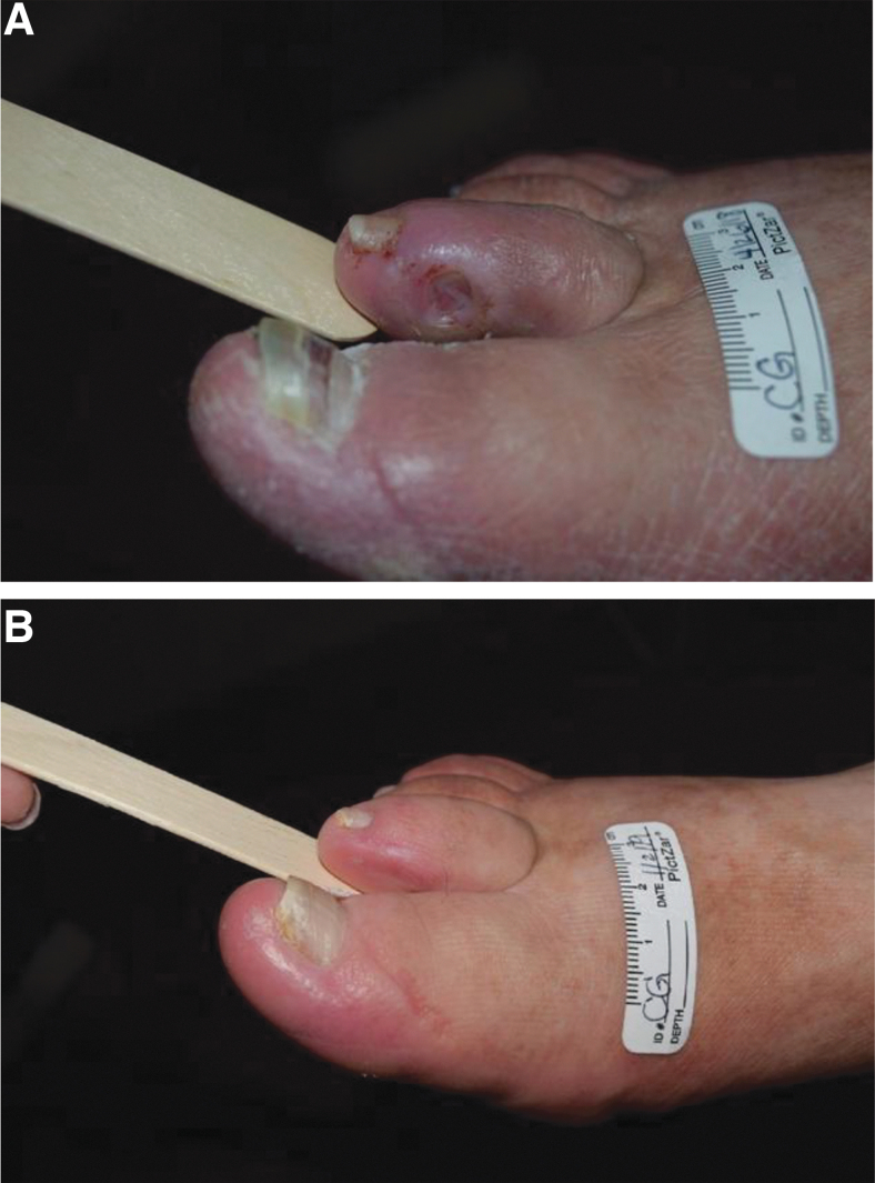 Photograph demonstrating assessment of foot sensation, pulses and pressure areas at risk of ulceration.
