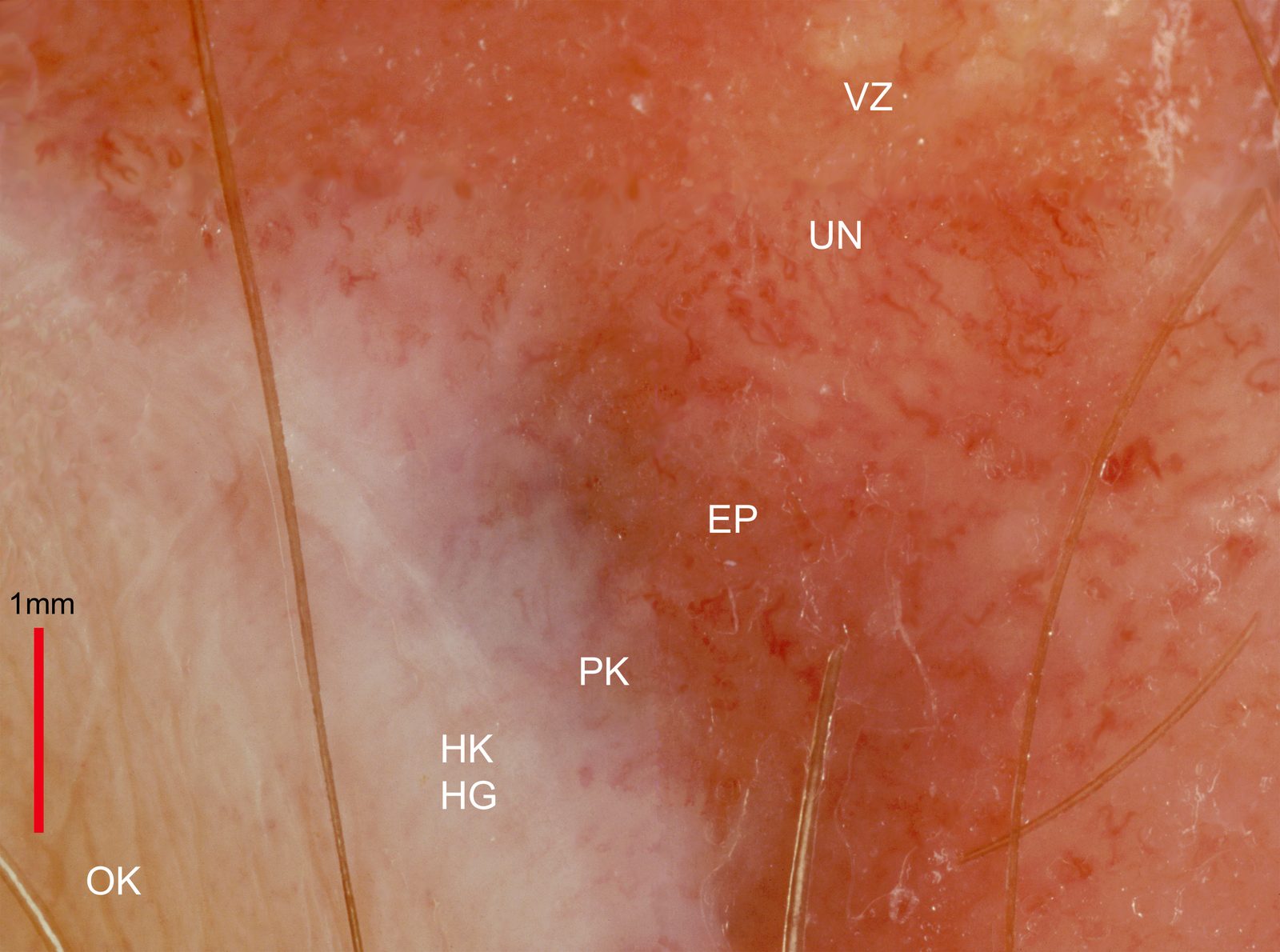 Sensitive clinical image, hidden